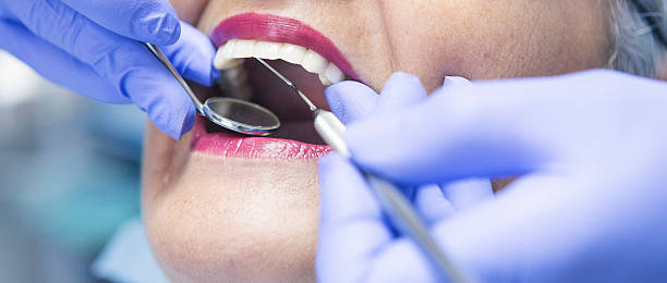 Best Knocked-Out Tooth (Avulsed Tooth) Treatment in Flora Vista, NM